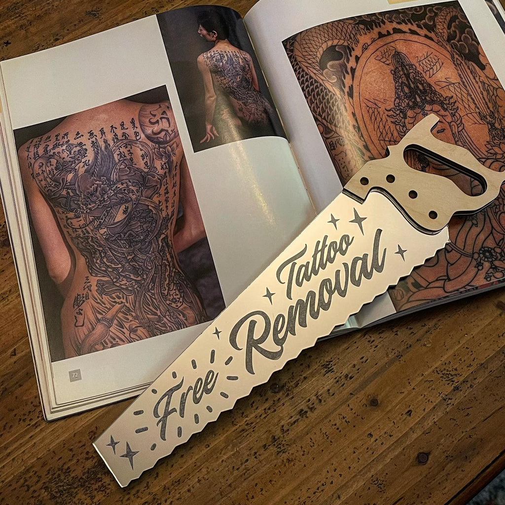 Free Tattoo Removal
